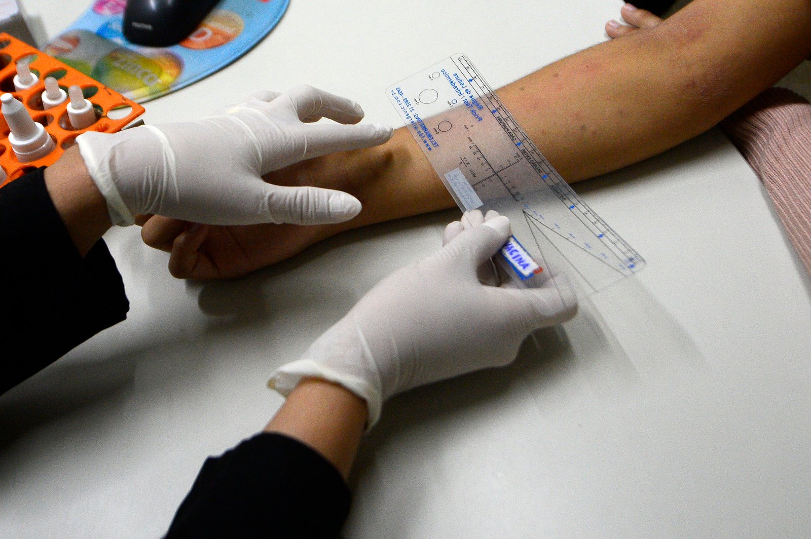 Policlínica de Taguatinga amplia tratamento especializado a pacientes com alergias